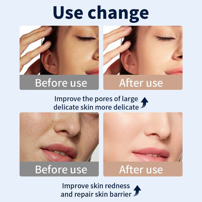 7 Color LED Face Mask