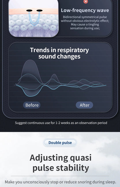 Smart Anti Snoring Device